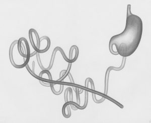 vergoeding darmonderzoek 2026